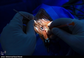 خطر پارگی چشم و نابینایی بر اثر استفاده از مواد منفجره